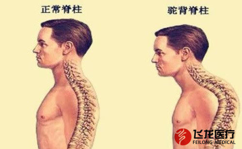 脊柱健康，不向生活&ldquo;低頭&rdquo;